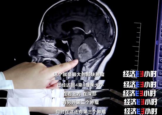 手术，生命之光的瞬间绽放