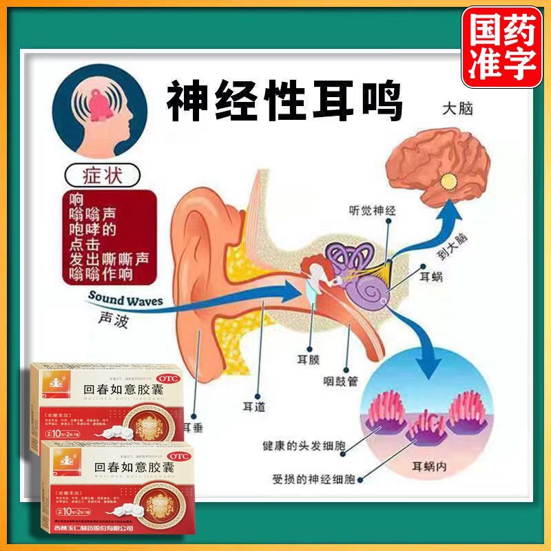 神经性耳鸣的特效药，探索与发现