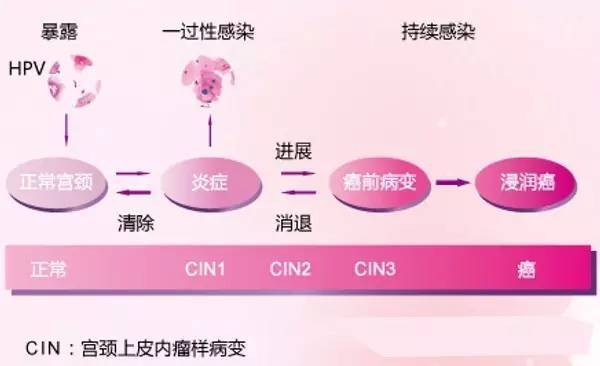 探索HPV感染的药物治疗新路径