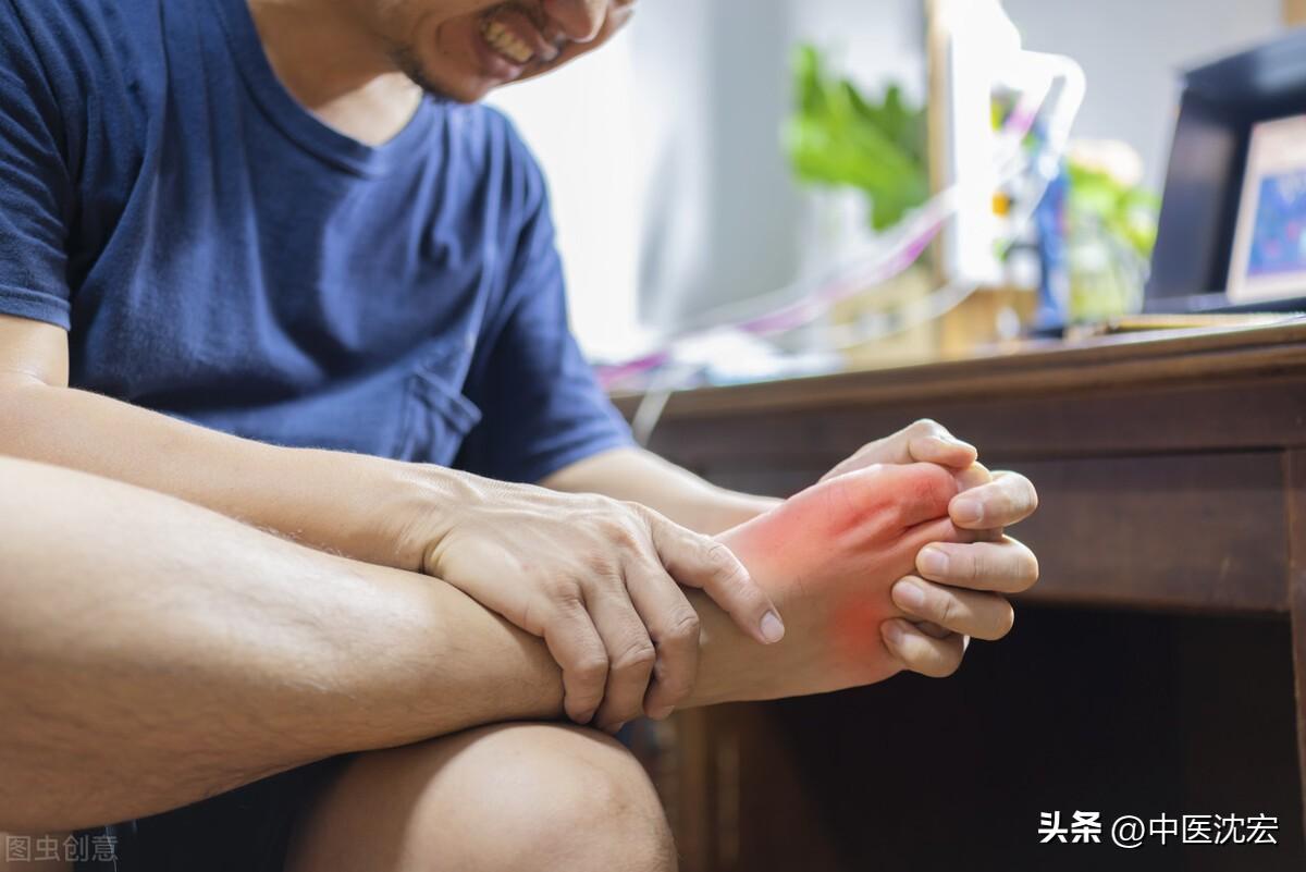 探索治疗痛风的新希望，特效中成药的潜力与挑战
