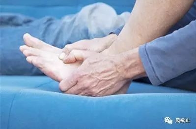 痛风治疗新视角，综合疗法与日常管理并重
