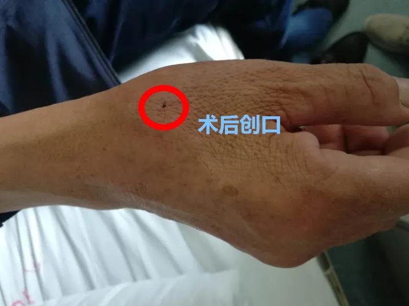 开展治疗，深度解析其意义与实施路径