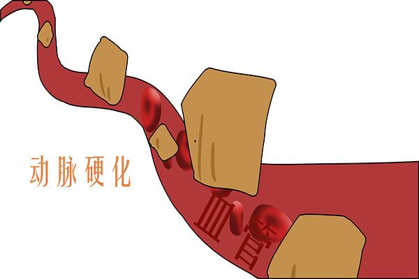 探索治疗勃起不硬的有效方法，深入解析他那达