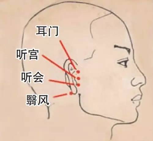 穴位疗法，揭秘治疗耳鸣的最佳穴位