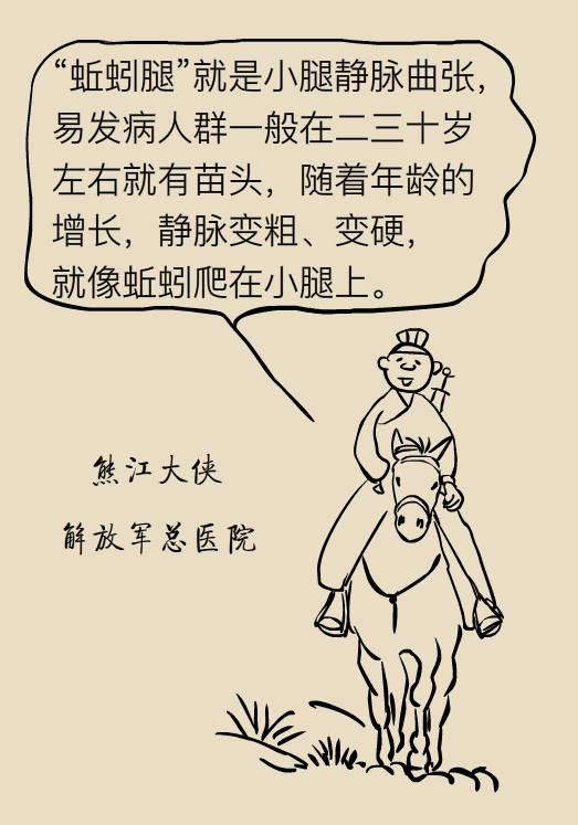 揭秘治疗静脉曲张的天然小妙招，轻松告别蚯蚓腿