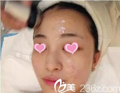 寻找最佳治疗青春痘的医院，专业与口碑并重的选择指南
