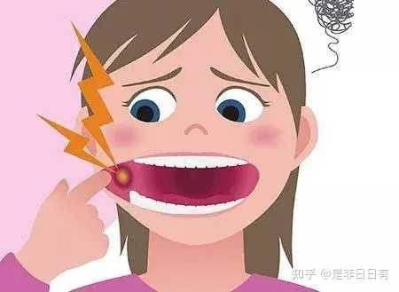 5种治疗口腔溃疡小妙招，奇效速愈