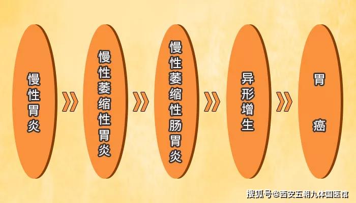 7个自然偏方助你缓解萎缩性胃炎