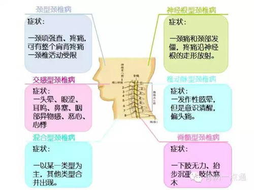 最佳治疗颈椎病方法探析，综合策略与个人化方案