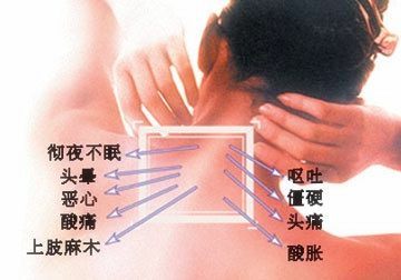 快速有效治疗颈椎病的民间偏方与科学方法