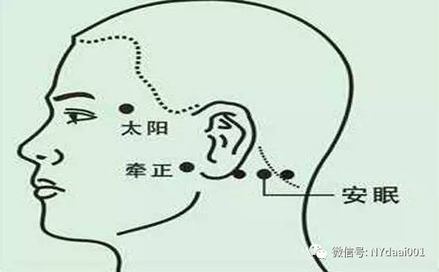 穴位图，解锁治疗失眠的秘密