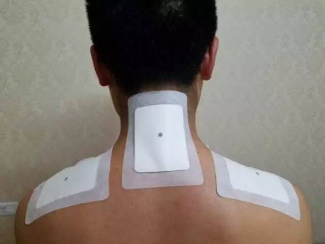 守护颈椎健康，探索治疗颈椎的膏药奥秘