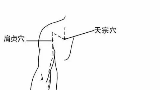 穴位疗法，揭秘治疗颈椎问题的关键穴位