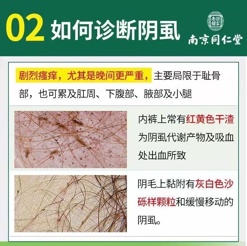 阴虱的治疗方法与用药指南