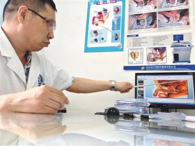 揭秘男科医院骗局，腔道仪器之谜
