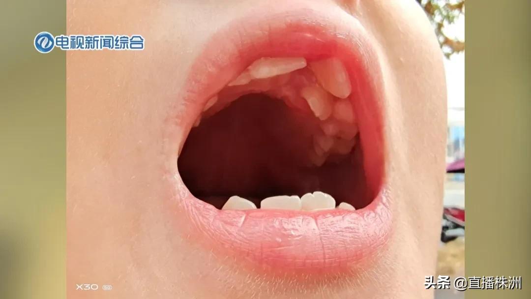 医院挂号新选择，哪个小程序最便捷？