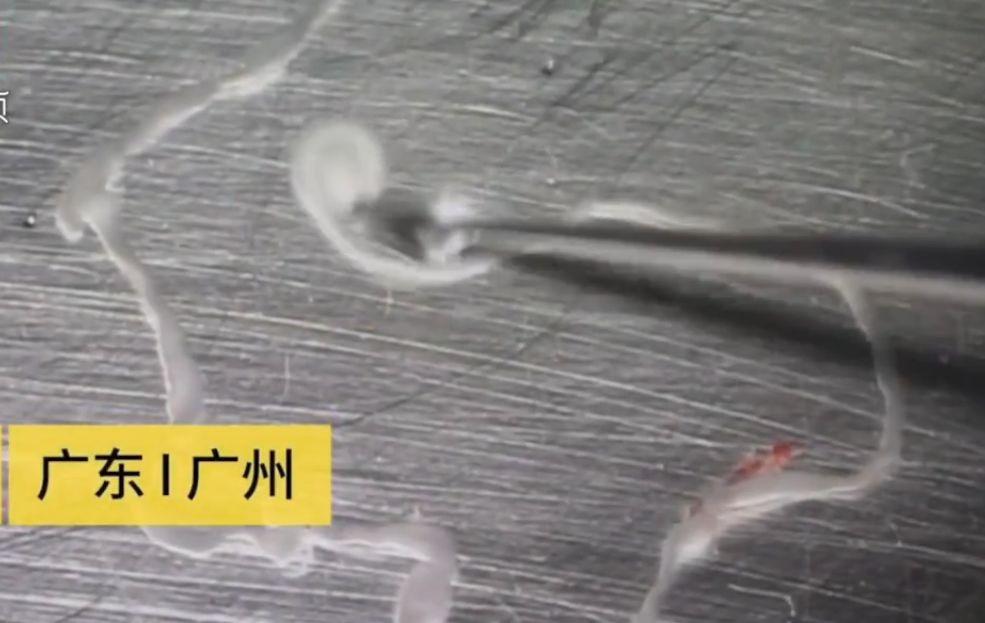 医院一般早上几点上班，了解就医前的准备与注意事项