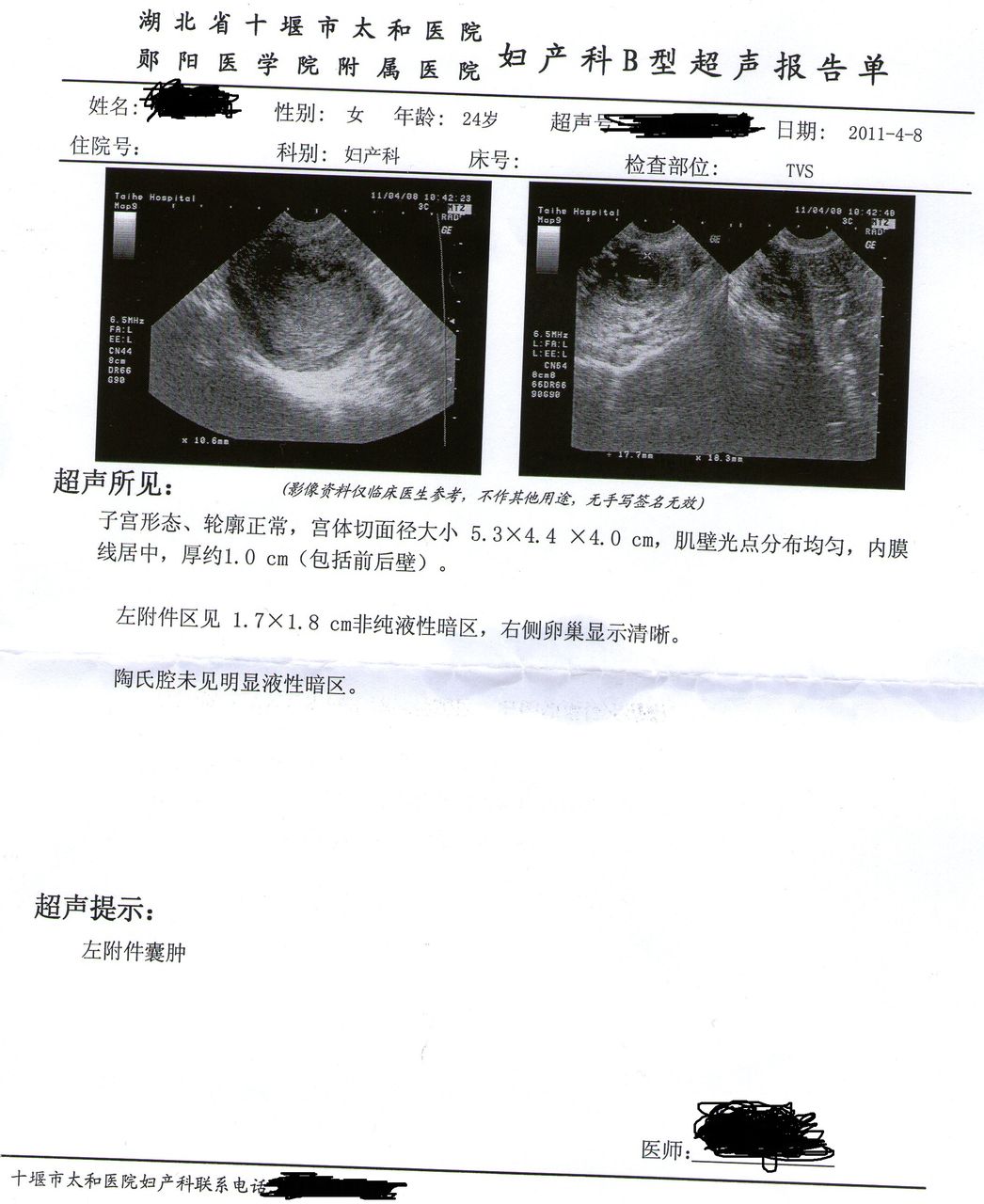 晚上医院妇科做B超的指南与注意事项