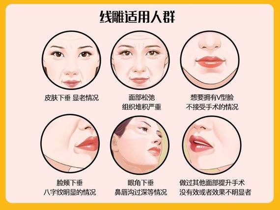 深圳医院点痣，价格、恢复时间与注意事项全解析