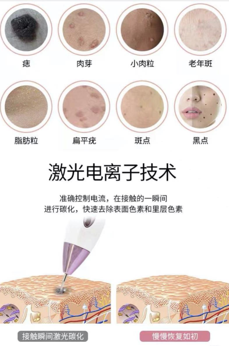 深圳医院点痣价格解析，一颗牙的美丽代价
