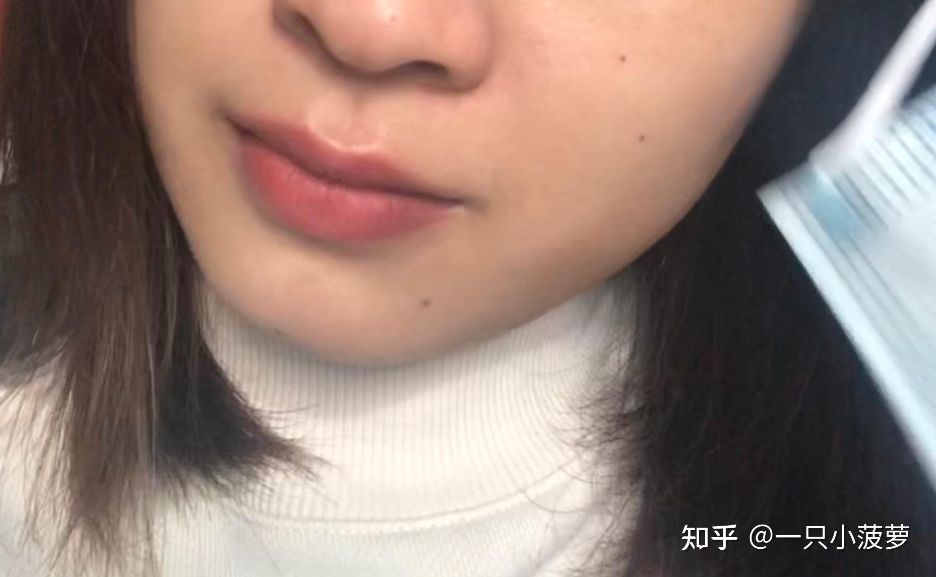 医院点痣价格，一克之差的背后与考量