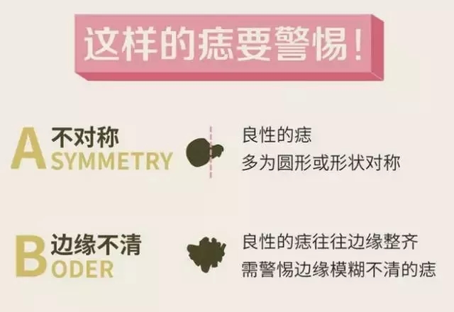 祛痣，医院与美容医院的优劣比较