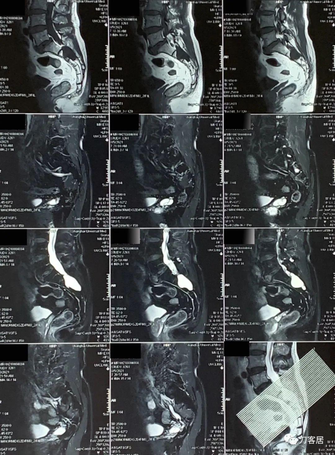 医院骨科照片（X光、CT、MRI）检查费用详解