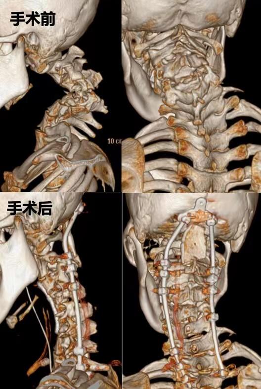真实骨科治疗现场，医院照片与视频的深度剖析