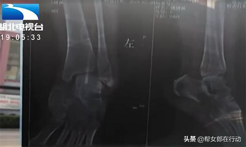 医院护工照顾病人的一天费用解析