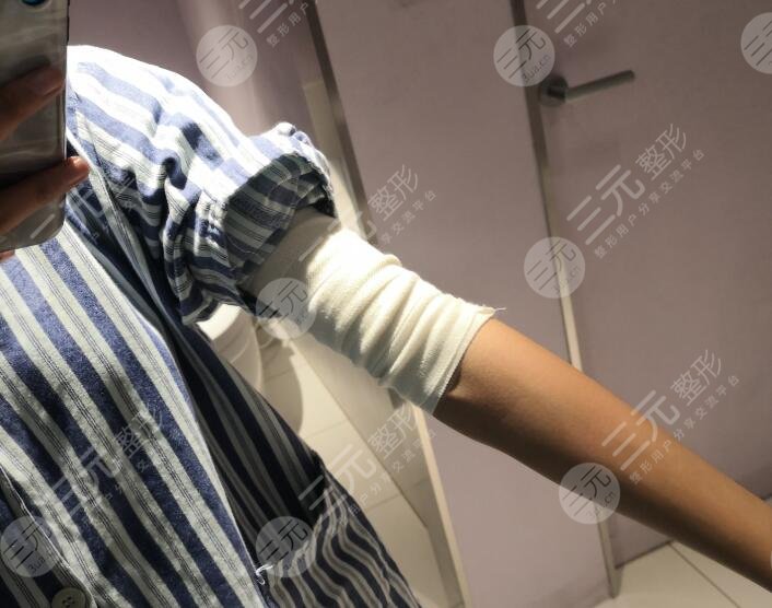 医院照片，手臂拍摄的背后与价值