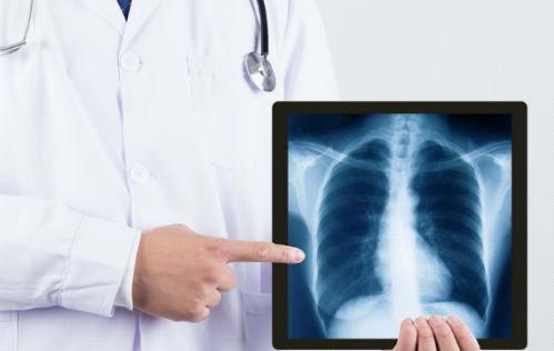 医院CT与X光片，技术原理、应用及差异解析