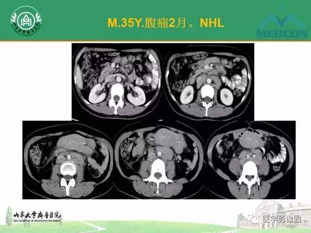 医院DR与CT，两种重要影像技术的区别与比较