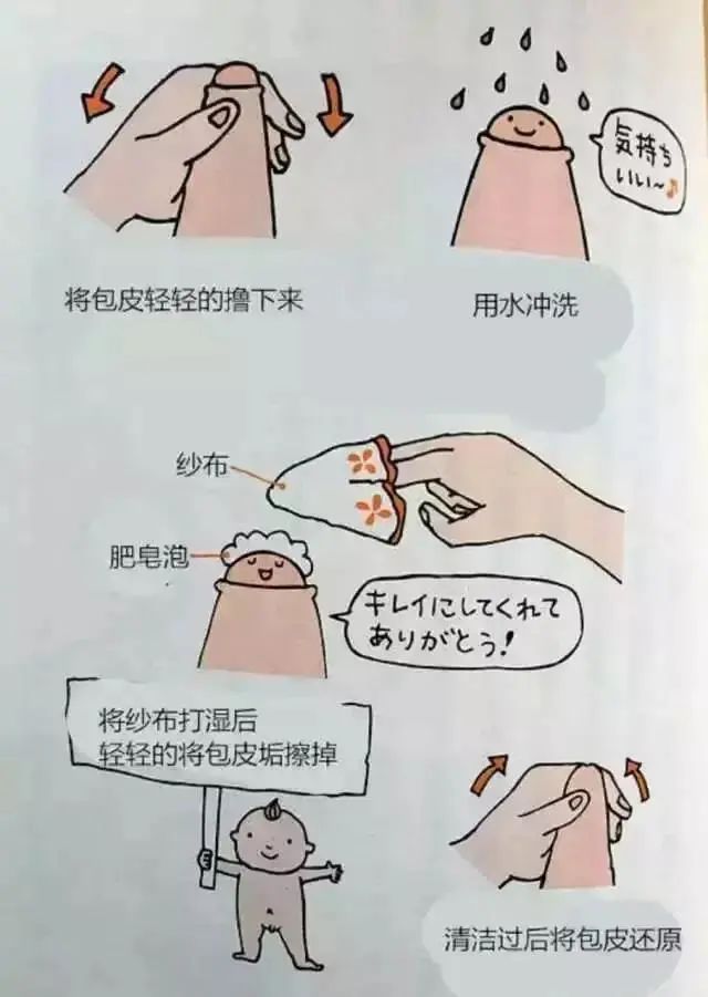 割包皮，选择合适医院的全面指南