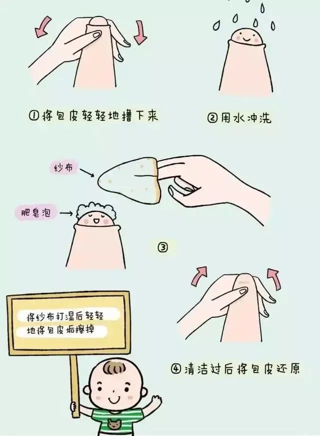 廊坊地区割包皮医院的选择与注意事项