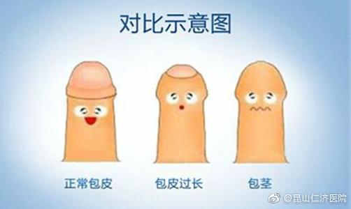昆山割包皮医院指南，专业选择与注意事项