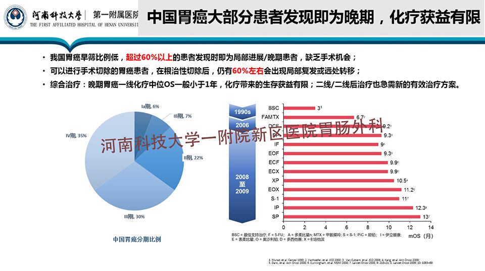 胃癌晚期治疗新希望，寻找最佳医疗机构的指南